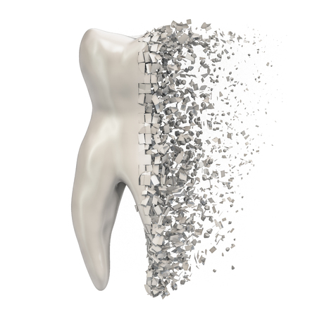 Tooth decay concept, 3D rendering isolated on white backgroundの写真素材