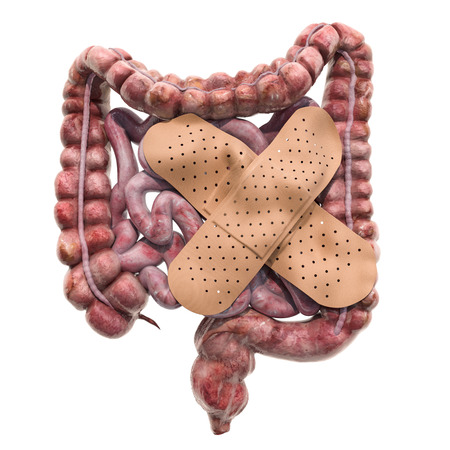 Human bowel with adhesive bandages. Treatment of intestines concept, 3D rendering isolated on white...