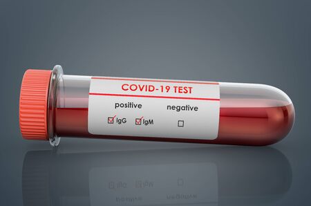 Coronavirus test, COVID-19. Test tube with positive blood samples for Coronavirus test COVID-19, 3D renderingの写真素材