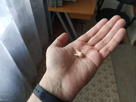 Man hand holds the extracted toothの写真素材