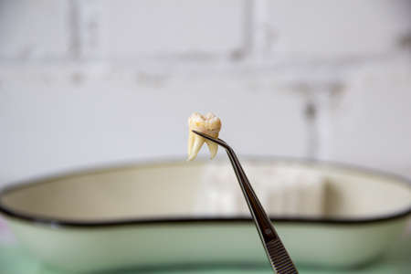Dentist shows the extracted tooth in a tweezersの写真素材