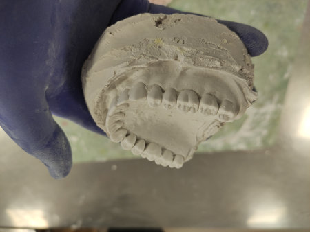 Dentist holding a plaster cast of teeth in his hand