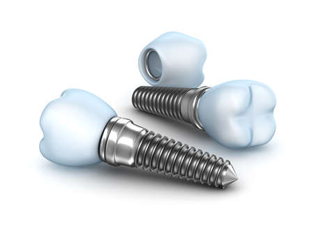 Dental implants , crown with pin isolated on white