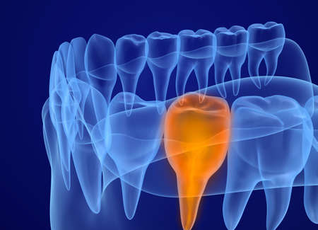 Mouth gum and teeth xray view. Medically accurate tooth 3D illustrationの写真素材