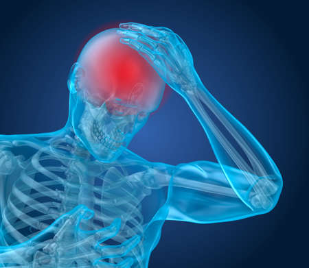 Head pain Attack, man suffering from brain pain. 3D illustrationの写真素材