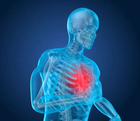 Heart Attack, man suffering from heart pain. 3D illustrationの写真素材