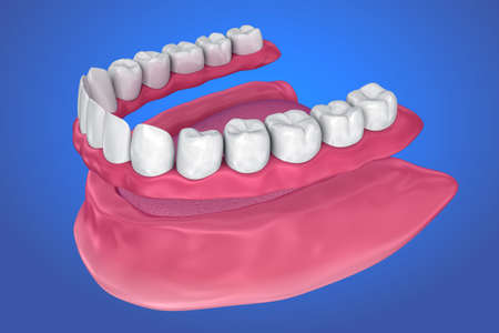 All missing teeth - removable full denture. 3D illustrationの写真素材