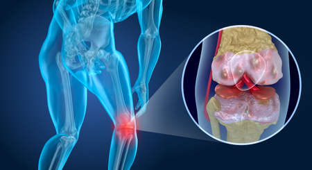Knee pain Attack, man suffering from knee. 3D illustrationの写真素材