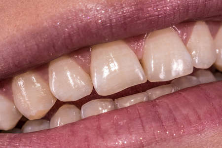 Woman smile with great natural teeth