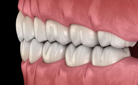 Healthy human teeth with normal occlusion, side view. Medically accurate tooth 3D illustration
