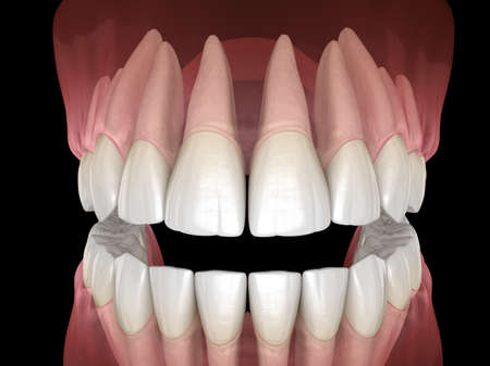 Morphology of mandibular and maxillary human gum and teeth. Medically accurate tooth 3D illustration