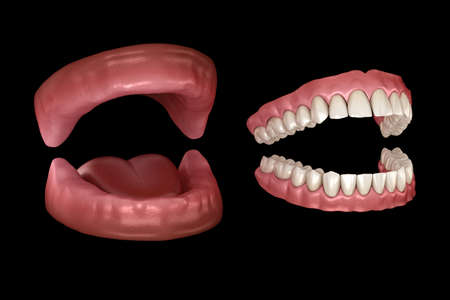 Maxillary and Mandibular prosthesis, artificial dentures. Medically accurate 3D illustration of human teeth and denturesの写真素材