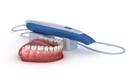 Intraoral Teeth 3D scanner. My own design. 3D illustration conceptの写真素材