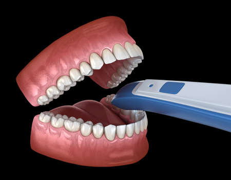 Intraoral Teeth 3D scanner. My own design. 3D illustration conceptの写真素材