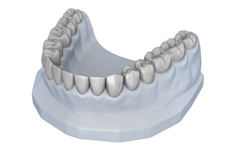 Wax-up teeth model. Treatment Planning. Medically accurate tooth 3D illustration