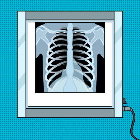 Xray image of chest in negative observer pop art retro vector illustration. Color background. Comic book style imitation.のイラスト素材