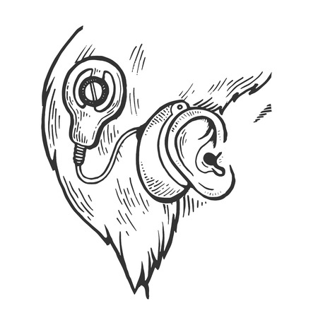Cochlear implant on child head engraving vector illustration. Scratch board style imitation. Black and white hand drawn image.のイラスト素材