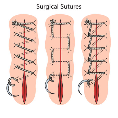 Surgical suture diagram schematic vector illustration. Medical science educational illustrationのイラスト素材