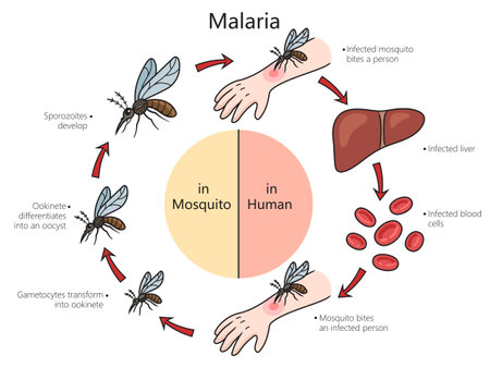 Malaria disease diagram hand drawn schematic vector illustration. Medical science educational illustrationのイラスト素材