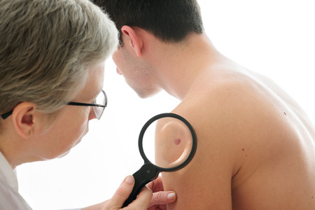 Dermatologist examines a mole of male patientの写真素材