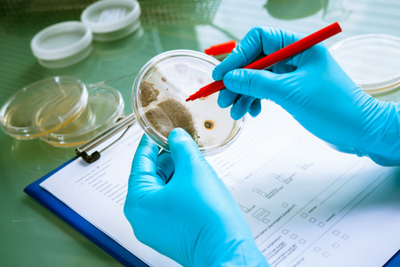 Germs growing on an agar plate in laboratory
