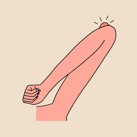 Inflammation of the elbow joint, bursitis, trauma, infection, arthritis. Vector illustration in flat style.のイラスト素材