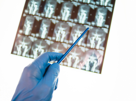 Doctor pointing at x-ray image of brainの写真素材