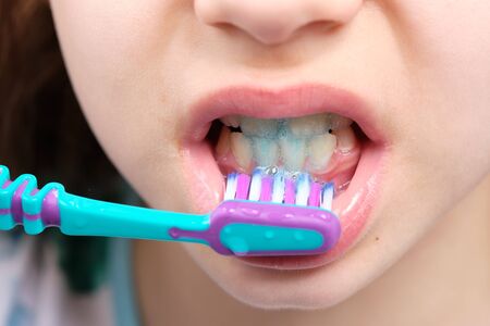 Woman brushing her teeth with a toothbrush,の写真素材