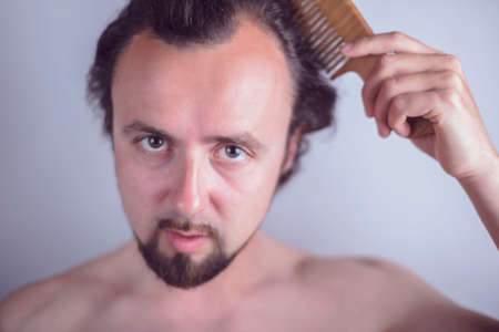 Portrait of a young guy with magnificent hair that falls early on his forehead. The problem of premature aging. Combing hair and indignantly looking in the mirror. Genetic predisposition to hair loss in men. Diseases of the scalp. Testosterone-dependent hair loss problems in menの写真素材