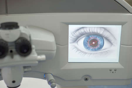 laser eye surgery. Close-up of the workplace of an ophthalmologist, monitor with a graphic image of...