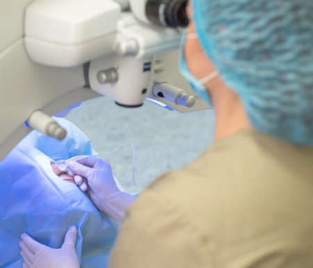 Ophthalmologist surgeon using a modern laser ophthalmological apparatus. Close up of cataract treatment doctor for patient in operating room. Surgical correction of eye diseases. Treatment for vision loss. Sterile operating room. The surgeon treats a patient with sore eyes. Modern methods of treatment and diagnosis of eye diseasesの写真素材