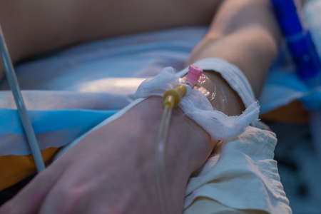 close-up, a catheter for a dropper in a child in a vein. A small patient lies on an operating table, sedation and anesthesia. Diseases that threaten the life of a child. Resuscitation of children. Recovery of vital body functions. Intravenous drip solutionの写真素材