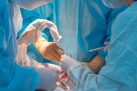 close-up - a team of pediatric surgeons performing an operation for ear lymphadenitis. Oncologists perform a puncture for diagnosis. Malignant oncology in pediatric surgery. Sterile operating room. Surgical instruments, medicine. Blue light operating lamp.の写真素材