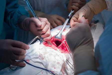 a surgeon with assistants, in a sterile operating room, is operated on internal organs. Blue cold...