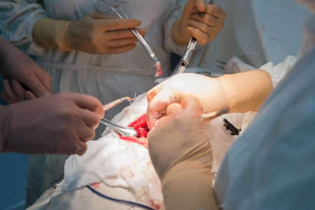 a surgeon with assistants, in a sterile operating room, is operated on internal organs. Blue cold surgical glow. The surgeon's hands hold the instrument, manipulating. Children's surgeons perform kidney surgeryの写真素材