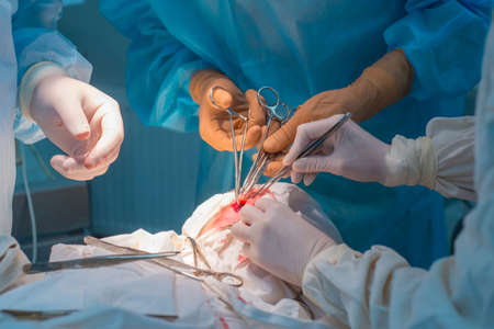 close-up, the hands of pediatric surgeons and an assistant operating a small patient with behind-the-ear lymphadenitis. In a sterile operating room. Removing a malignant tumor of the ear with a scalpel, suturing soft tissues, electrocoagulation, stopping bleeding. Plastic and reparative surgery. Oncology of children, surgery on the lymph nodesの写真素材