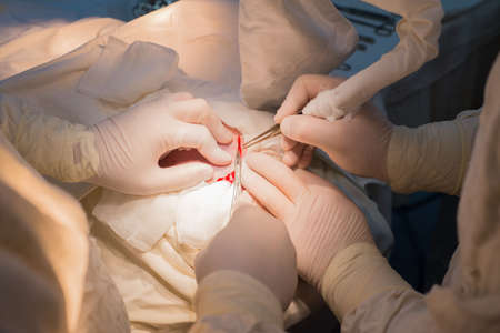 top view, stages of neurosurgical surgery for installing a titanium plate in the patients skull....