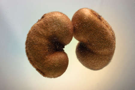 Kiwi fruits, similar to the kidneys. Kidney health concept. Promotional photo. Kiwi cut in half, with air bubbles, under water, resembling the shape of a kidney. Genitourinary system, anatomy. A blank for an article on kidney disease. Nephrology and urology. Treatment of kidney disease. Kidney stonesの写真素材