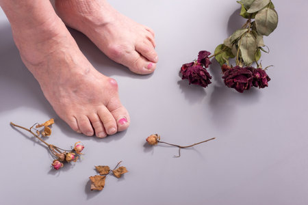 concept of foot disease in old woman with dry flowers.の写真素材