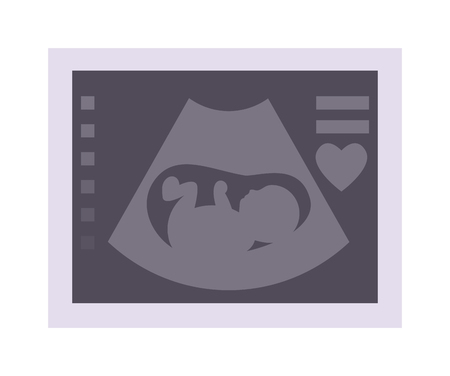 Obstetric ultrasound baby of fetus ecography scan. Vector illustration ultrasound baby pregnant maternity photo. Ultrasonic scan photo expecting life ultrasound baby care, pregnancy sonar.のイラスト素材
