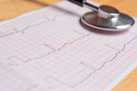 Healthy Heart cardiogram and stethoscopeの写真素材
