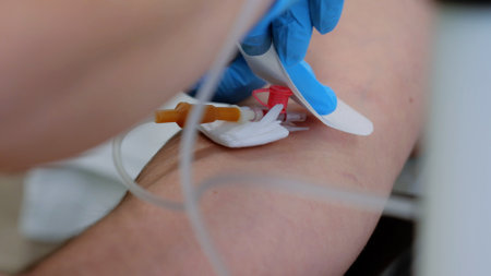 Medication flows through intravenous line into vein of patients hand close-up. Intravenous therapy administering drugs directly into bloodstream effective medical treatment modern medical practices.の写真素材