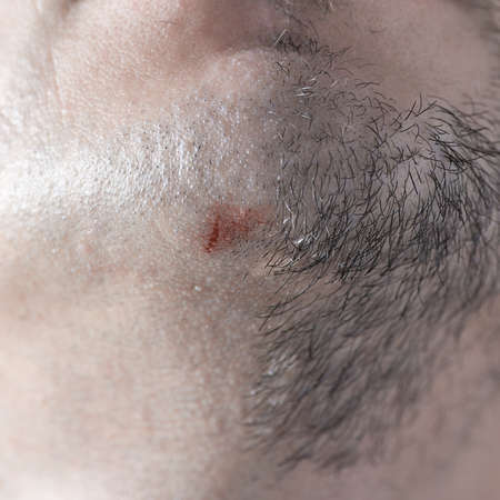 Male half-shaved chin with a razor cut close-up.の写真素材