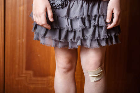 little girl hurt her knee. a scratched knee. brave girlの写真素材