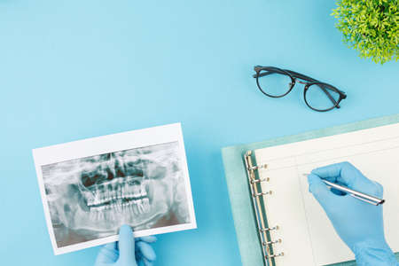 X ray of teeth with jaw model on the dentist tableの写真素材