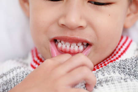 Closeup white teeth a boy of cute kid , adorable child in happy.の写真素材