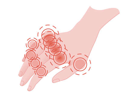 Human pain in the fingers with red pain circle flat vector illustration on white background?のイラスト素材