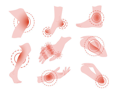 Set of painful leg and hand concept with pain red circle cartoon flat design vector illustration on white background.のイラスト素材