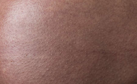 Macro of Human pregnant abdomen skin pattern with cells and lines texture.の写真素材