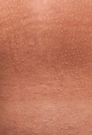 Macro of Human skin pattern with cells and lines texture.の写真素材